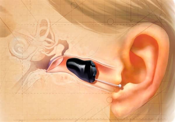 आईआईसी कान की मशीन उपयोगकर्ता-सबसे अच्छी कान की मशीन blog image