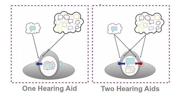 एक और दो कान की मशीन के बीच तुलना blog image