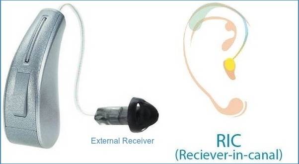 कैनाल में रिसीवर या RIC कान की मशीन blog image