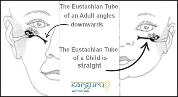 बाल और वयस्क की यूस्टेशियन ट्यूब की तुलना blog iamge