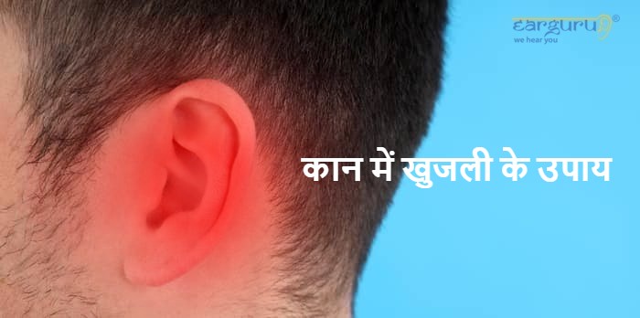 कान में खुजली के उपाय blog feature image