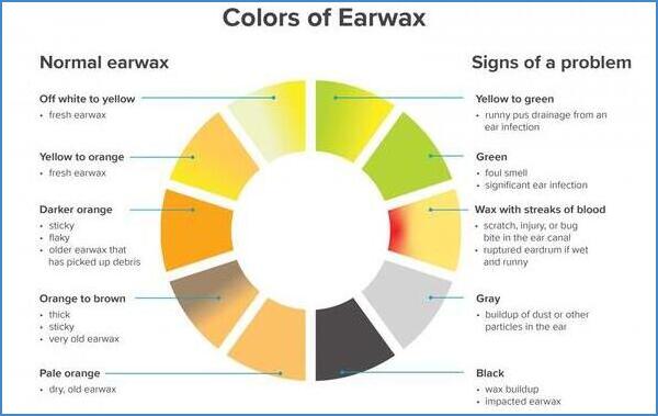Earwax color indicator chart blog image
