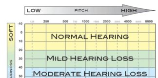Hearing loss treatment Audiogram chart blog image