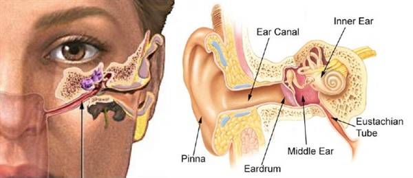 Ear infections through the Eustachian Tube