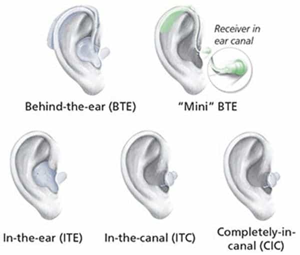 Styles of Digital Hearing Aids