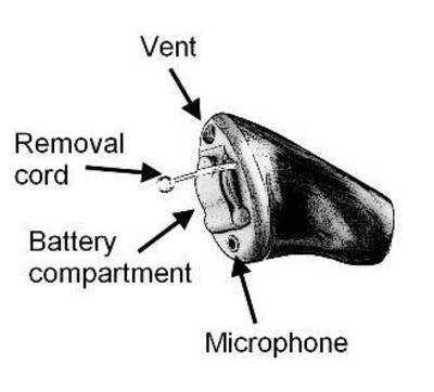 ITC Hearing Aid with Vent for High Frequency Hearing Loss