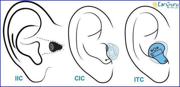 Styles of invisible Hearing aids