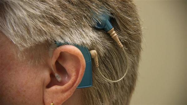 Older Adult Cochlear Implant Recipient