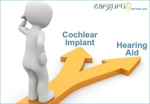 Cochlear Implant vs Hearing Aid. What's Best