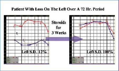 Audiogram Report of improvement in hearing after treatment blog image