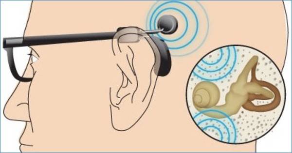 Bone Conduction Hearing Aid with Spectacles blog image