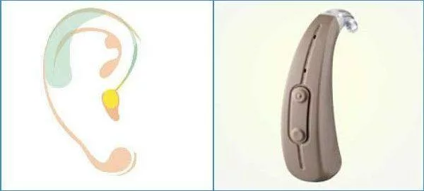 Digital BTE Hearing Aid blog image