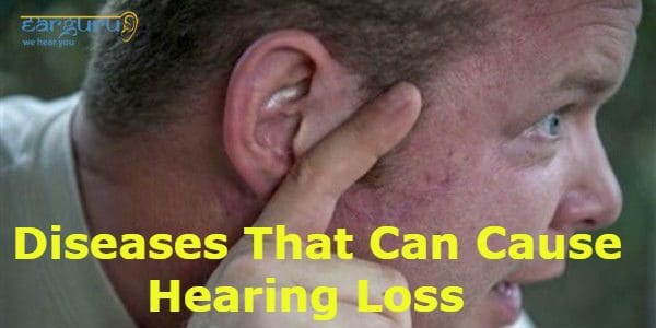 Diseases that can cause hearing Loss blog feature image