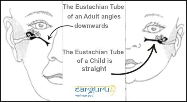 Eustachian Tube Comparison of Child and Adult blog image
