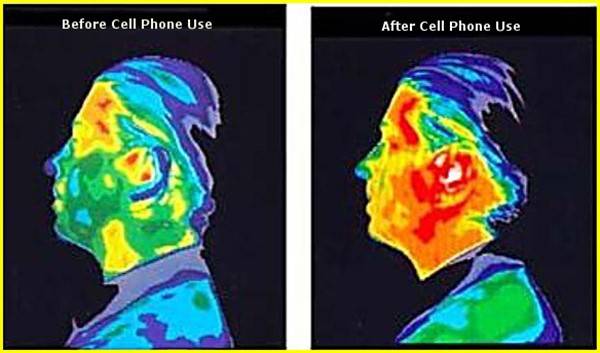 Heat effect on the head due to cell phone usage blog image