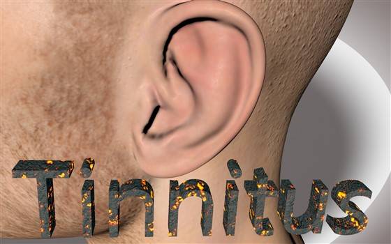 Must Read Guide To Tinnitus Symptoms Causes And Treatments