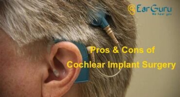 Pros and Cons of Cochlear Implant Surgery