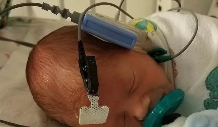 Neonatal Hearing Screening blog image