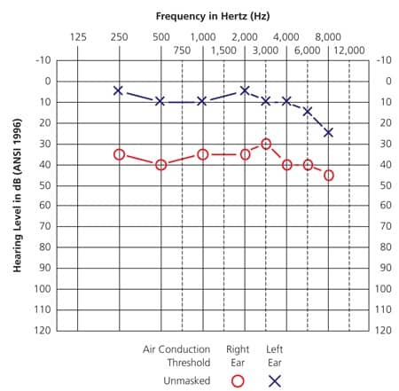 Audiogram chart blog image