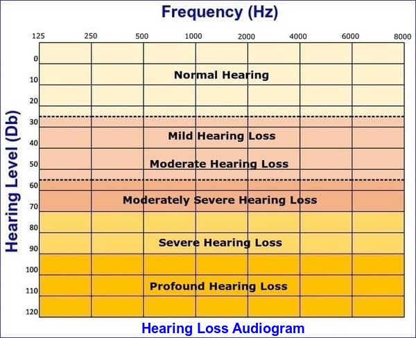 Audiogram with hearing loss levels blog image
