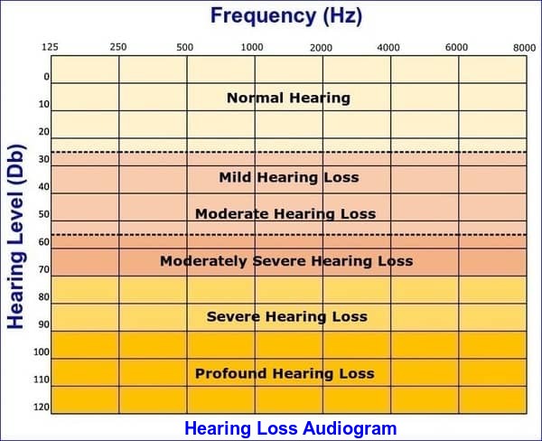 Answers To FAQs What Is Hearing Loss Causes Types Symptoms