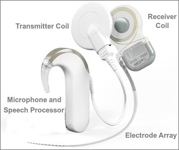 Cochlear Implant Parts blog image