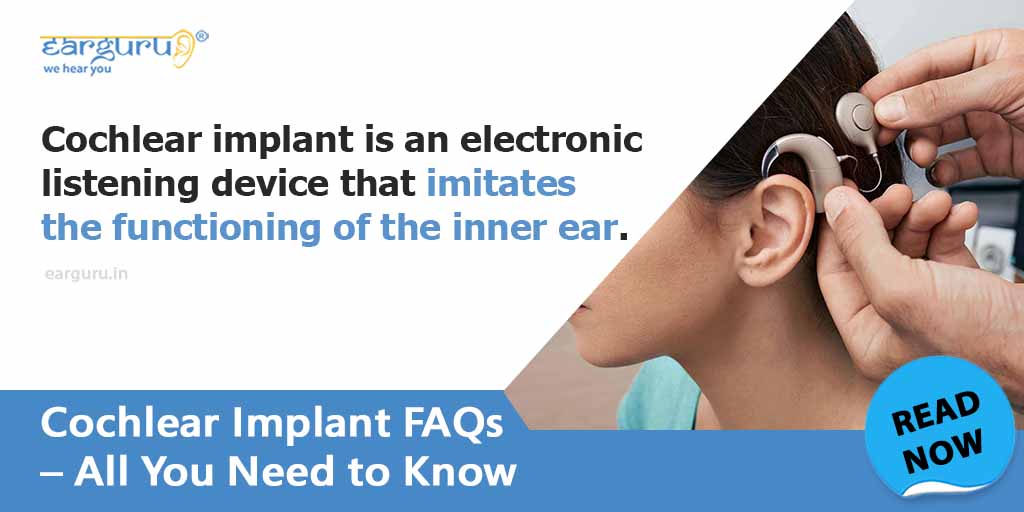 Frequently Asked Questions About Cochlear Implants