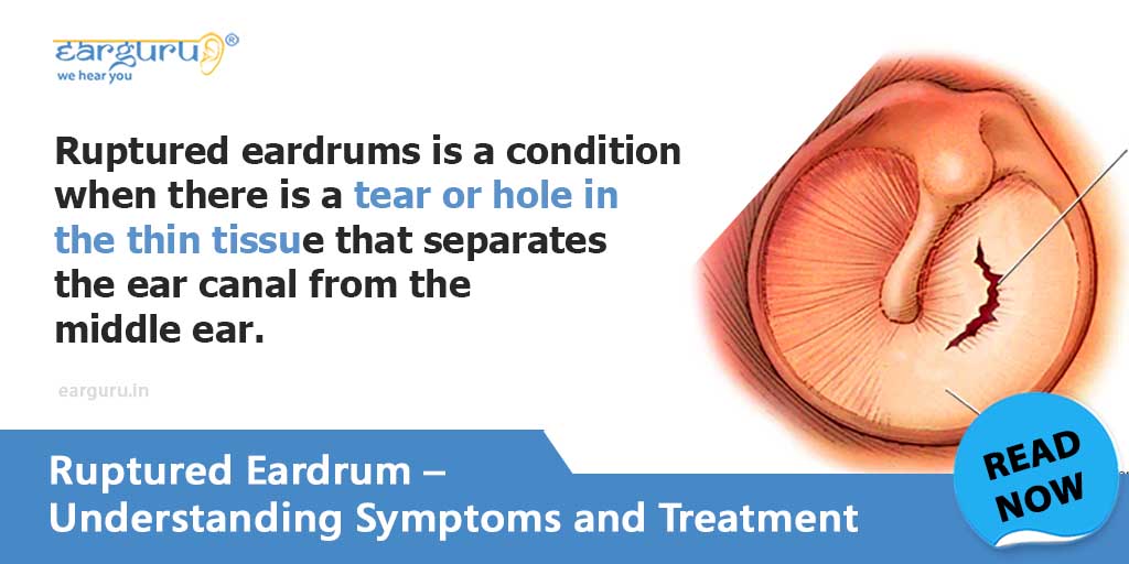 ruptured-eardrum-causes-symptoms-and-treatment